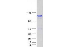 RAB11FIP4 Protein (Myc-DYKDDDDK Tag)