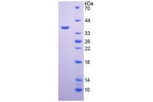 SDS-PAGE analysis of Mouse Arginase Protein. (ARG Protein)