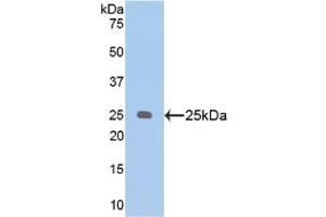 Western blot analysis of recombinant Human PSA. (NPEPPS Antikörper  (AA 584-793))