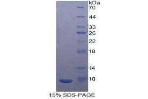 SDS-PAGE (SDS) image for Chemokine (C-X-C Motif) Ligand 2 (CXCL2) (AA 28-100) protein (His tag) (ABIN1980967)