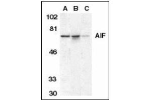 Western blot analysis of AIF in K562 cell lysate (A), mouse (B), and rat (C) liver tissue lysates with AIF antibody at 1 µg/ml. (AIF Antikörper  (AA 593-606))
