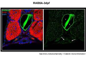 Sample type: zebra gut epithelial cellsGreen: primaryRed: actinBlue: DAPIPrimary dilution: 1:5000Secondary Dilution: 1:300Image Submitted by: Michel BagnatDuke University Medical Center . (RAB5 Antikörper  (Middle Region))