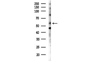 anti-CAP-GLY Domain Containing Linker Protein 3 (CLIP3) (Internal Region) antibody
