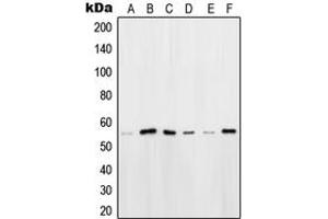 Western blot analysis of OCT2 expression in HeLa (A), HEK293T (B), Ramos (C), K562 (D), Raji (E), NIH3T3 (F) whole cell lysates. (Oct-2 Antikörper  (N-Term))