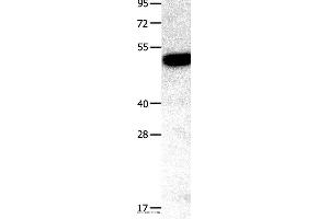 Western blot analysis of Mouse kidney tissue, using TNFRSF11B Polyclonal Antibody at dilution of 1:400 (Osteoprotegerin Antikörper)