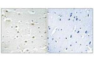 Immunohistochemistry analysis of paraffin-embedded human brain tissue using DDX3Y antibody. (DDX3Y Antikörper)