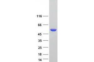 Western Blotting (WB) image for Aldehyde Dehydrogenase 3 Family, Member A1 (ALDH3A1) (Transcript Variant 3) protein (Myc-DYKDDDDK Tag) (ABIN2714543)