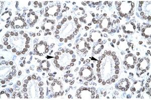 Immunohistochemistry (IHC) image for anti-Cbp/p300-Interacting Transactivator, with Glu/Asp-Rich Carboxy-terminal Domain, 1 (CITED1) (Middle Region) antibody (ABIN2777537)
