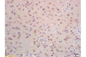 Formalin-fixed and paraffin embedded rat brain labeled with Rabbit Anti Histone H3-like protein Polyclonal Antibody, Unconjugated (ABIN670986) at 1:200 followed by conjugation to the secondary antibody and DAB staining (Centromeric Histone H3-Like Protein-2 (AA 51-145) Antikörper)