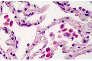 Human Lung: Formalin-Fixed, Paraffin-Embedded (FFPE) (TMEM123 Antikörper  (AA 173-188))