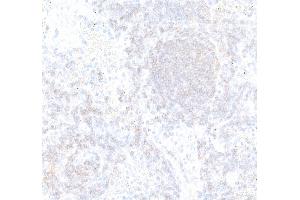Immunohistochemistry (IHC) image for anti-CD22 Molecule (CD22) (AA 750-800) antibody (ABIN7795736)