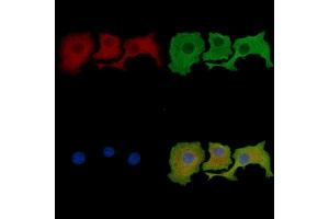 ABIN7095689 and ABIN7099751 staining HepG2 cells by IF/ICC. (ZBTB7C Antikörper)