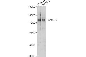 Western blot analysis of extracts of various cell lines, using GALNT6 antibody (ABIN6294086) at 1:1000 dilution. (GALNT6 Antikörper)