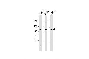 Western Blot at 1:2000 dilution Lane 1: A375 whole cell lysate Lane 2: Hela whole cell lysate Lane 3: K562 whole cell lysate Lysates/proteins at 20 ug per lane.