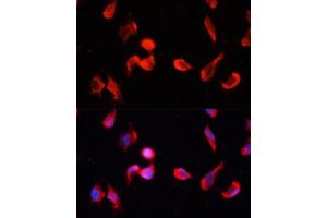 Immunofluorescence analysis of HeLa cells using CG Polyclonal Antibody (ABIN1678951, ABIN3017618, ABIN3017619 and ABIN6220165) at dilution of 1:100 (40x lens). (CAMKII gamma Antikörper  (AA 300-410))