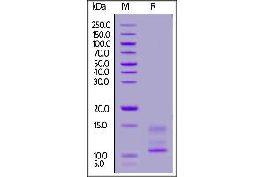 SDS-PAGE (SDS) image for Mucin 1 (MUC1) (AA 254-373) protein (His tag) (ABIN7013642)