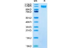 SDS-PAGE (SDS) image for SARS-CoV-2 Spike S1 (C.37 - Lambda) protein (His tag) (ABIN7275137)