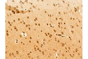ABIN7094774 and ABIN7098825 at 1/100 staining Rat brain tissue by IHC-P. (PDE1C Antikörper  (Internal Region))