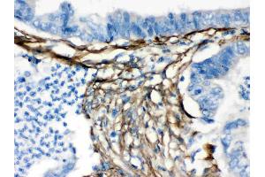 Caldesmon was detected in paraffin-embedded sections of human intestinal tissues using rabbit anti- Caldesmon Antigen Affinity purified polyclonal antibody (Catalog # ) at 1 ? (Caldesmon Antikörper  (AA 1-120))