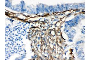 Caldesmon was detected in paraffin-embedded sections of human intestinal tissues using rabbit anti- Caldesmon Antigen Affinity purified polyclonal antibody (Catalog # ) at 1 ?