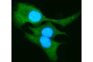 anti-Aldo-Keto Reductase Family 1, Member B10 (Aldose Reductase) (AKR1B10) (AA 285-316), (C-Term) antibody