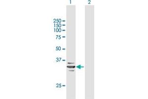 Western Blot analysis of RARRES1 expression in transfected 293T cell line by RARRES1 MaxPab polyclonal antibody. (RARRES1 Antikörper  (AA 1-294))