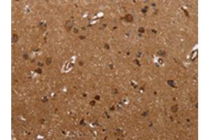 The image on the left is immunohistochemistry of paraffin-embedded Human brain tissue using ABIN7190664(FMN2 Antibody) at dilution 1/30, on the right is treated with synthetic peptide.