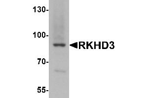 Western blot analysis of RKHD3 in mouse skeletal muscle tissue lysate with RKHD3 antibody at 1 µg/mL. (MEX3B Antikörper  (Middle Region))