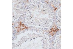 Immunohistochemistry of paraffin-embedded mouse testis using KIFC1 antibody (ABIN1680592, ABIN3017666, ABIN3017667 and ABIN6220203) at dilution of 1:100 (40x lens). (KIFC1 Antikörper  (AA 1-250))