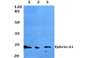 Western blot (WB) analyzes of Ephrin-A1 antibody at 1/500 dilution. (Ephrin A1 Antikörper)