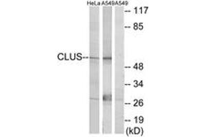 Western blot analysis of extracts from HeLa cells/A549 cells, using CLUS Antibody. (Clusterin Antikörper  (AA 400-449))