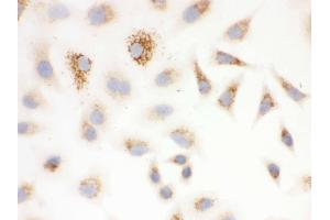 IHC analysis of SOD2  using anti-SOD2  antibody .