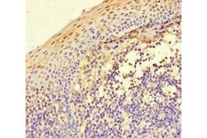 Immunohistochemistry of paraffin-embedded human tonsil tissue using ABIN7156438 at dilution of 1:100 (ITGA4 Antikörper  (AA 376-558))