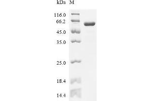 Cystatin S (CST4) (AA 1-461), (full length) protein (His tag)