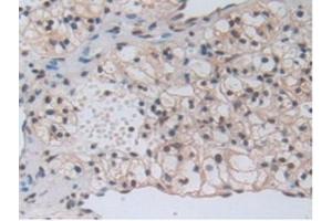Immunohistochemistry (IHC) image for anti-Pro-Platelet Basic Protein (Chemokine (C-X-C Motif) Ligand 7) (PPBP) (AA 59-128) antibody (ABIN7431659)