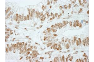 Immunohistochemistry (IHC) image for anti-Retinoblastoma Binding Protein 5 (RBBP5) (C-Term) antibody (ABIN7448757) (RBBP5 Antikörper  (C-Term))