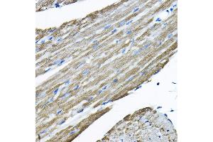 Immunohistochemistry of paraffin-embedded mouse heart using UBE2F Rabbit pAb  at dilution of 1:200 (40x lens). (UBE2F Antikörper  (AA 1-185))