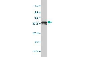 KRTHB1 monoclonal antibody (M01), clone 3B10-5B10 Western Blot analysis of KRTHB1 expression in HepG2 .