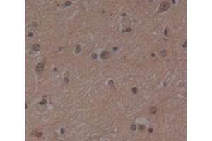 Used in DAB staining on fromalin fixed paraffin- embedded Kidney tissue (PSMD4/ASF Antikörper  (AA 1-377))