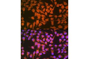 Immunofluorescence analysis of HeLa cells using CBS Rabbit mAb (ABIN7266615) at dilution of 1:100 (40x lens). (CBS Antikörper)