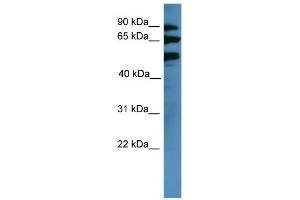 WB Suggested Anti-BBS2 Antibody Titration: 0. (BBS2 Antikörper  (Middle Region))