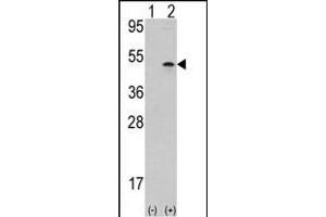 Western blot analysis of AURKB (arrow) using rabbit polyclonal Aurora-B (ARK/STK12) Antibody (Center) (ABIN391354 and ABIN2841375). (Aurora-B (ARK/STK12) (AA 283-313) Antikörper)