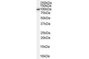 Western Blotting (WB) image for anti-Amyloid beta (A4) Precursor Protein-Binding, Family B, Member 1 (Fe65) (APBB1) (C-Term) antibody (ABIN2465409) (FE65 Antikörper  (C-Term))