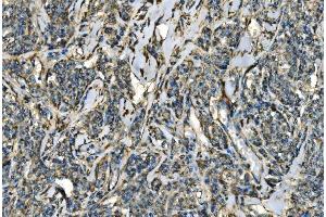 IHC analysis of CX3CR1 using anti-CX3CR1 antibody (ABIN7599293). (CX3CR1 Antikörper  (AA 1-345))