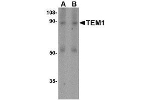 Image no. 1 for anti-CD248 Molecule, Endosialin (CD248) (N-Term) antibody (ABIN1494342) (CD248 Antikörper  (N-Term))
