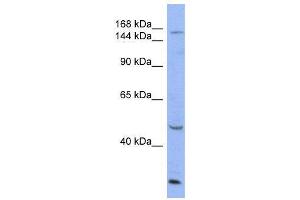 WB Suggested Anti-ATP7A  Antibody Titration: 0.