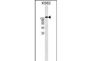 Western Blotting (WB) image for anti-ATP-Binding Cassette, Sub-Family B (MDR/TAP), Member 1 (ABCB1) (AA 647-677) antibody (ABIN1538560)