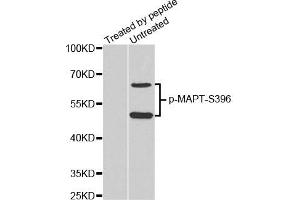 Western Blotting (WB) image for anti-Microtubule-Associated Protein tau (MAPT) (pSer396) antibody (ABIN1870397) (MAPT Antikörper  (pSer396))