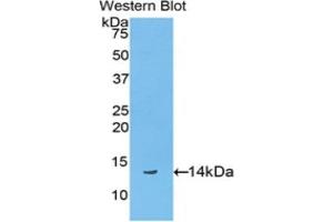Western blot analysis of the recombinant protein. (Biglycan Antikörper  (AA 48-158))