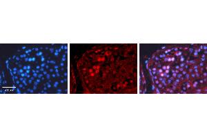 Rabbit Anti-CREB1 Antibody Catalog Number: ARP31264_T100 Formalin Fixed Paraffin Embedded Tissue: Human Testis Tissue Observed Staining: Nucleus Primary Antibody Concentration: 1:100 Other Working Concentrations: N/A Secondary Antibody: Donkey anti-Rabbit-Cy3 Secondary Antibody Concentration: 1:200 Magnification: 20X Exposure Time: 0. (CREB1 Antikörper  (N-Term))